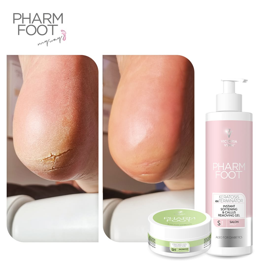 PHARM FOOT Komplekts saplaisājušu papēžu un pēdu ādas kopšanai