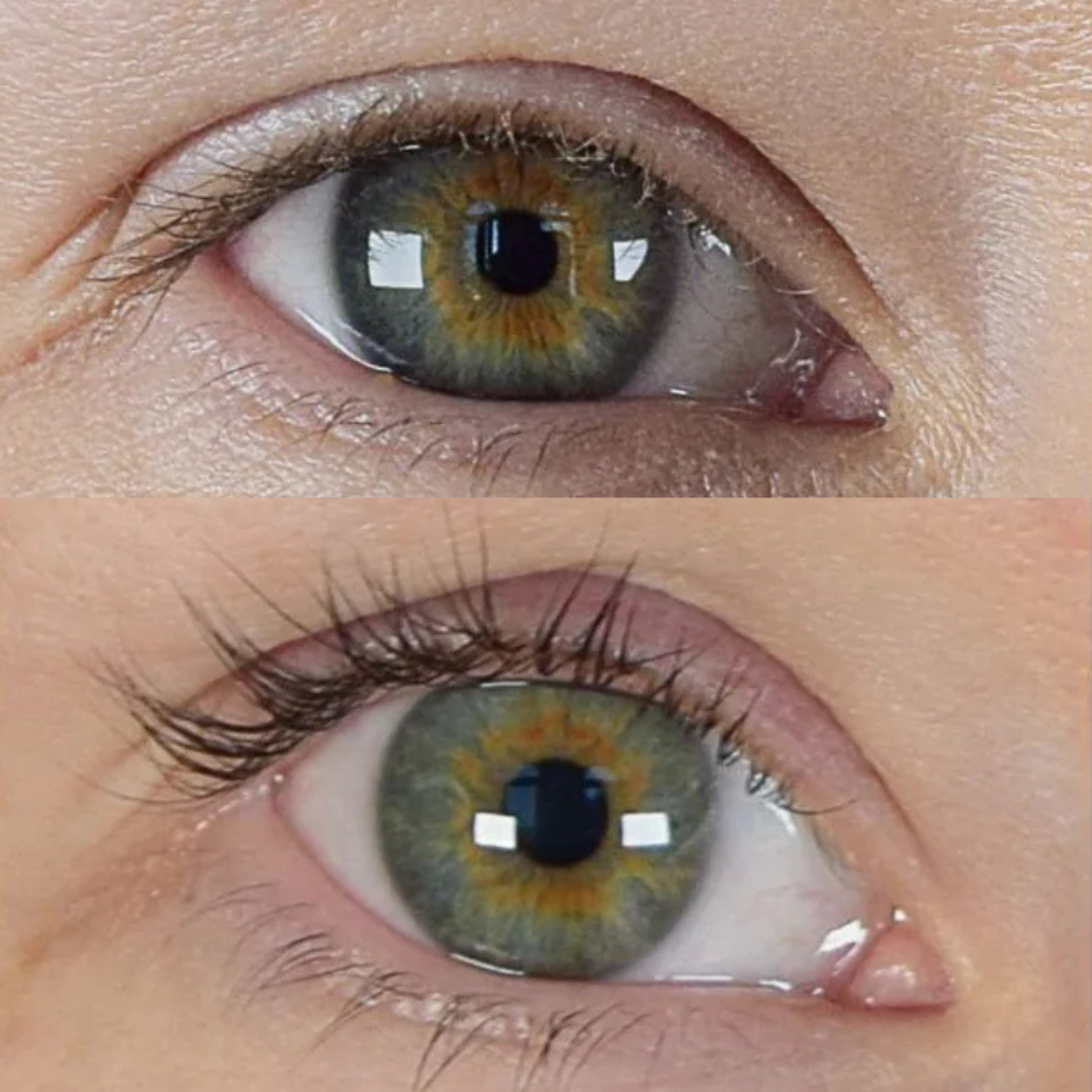 XLASH Sensitive Eyelash Serum, 3ml