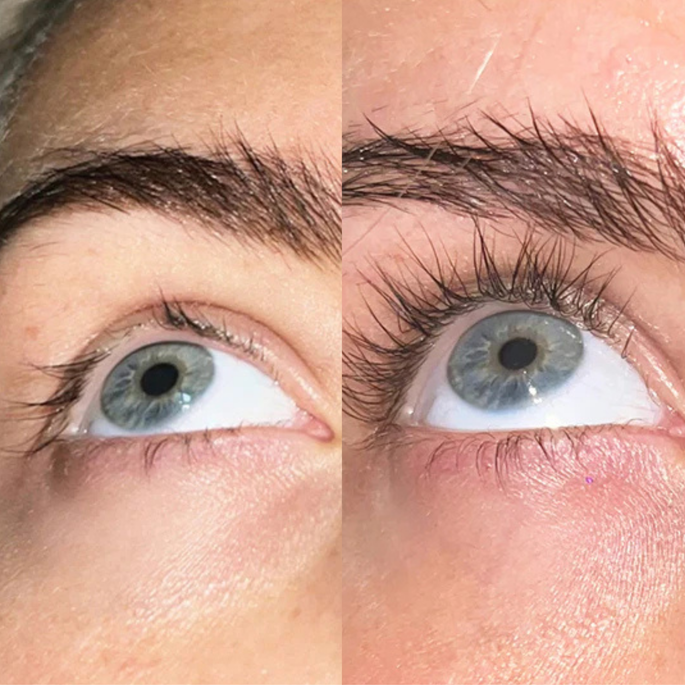Xlash Eyelash Serum, 5ml
