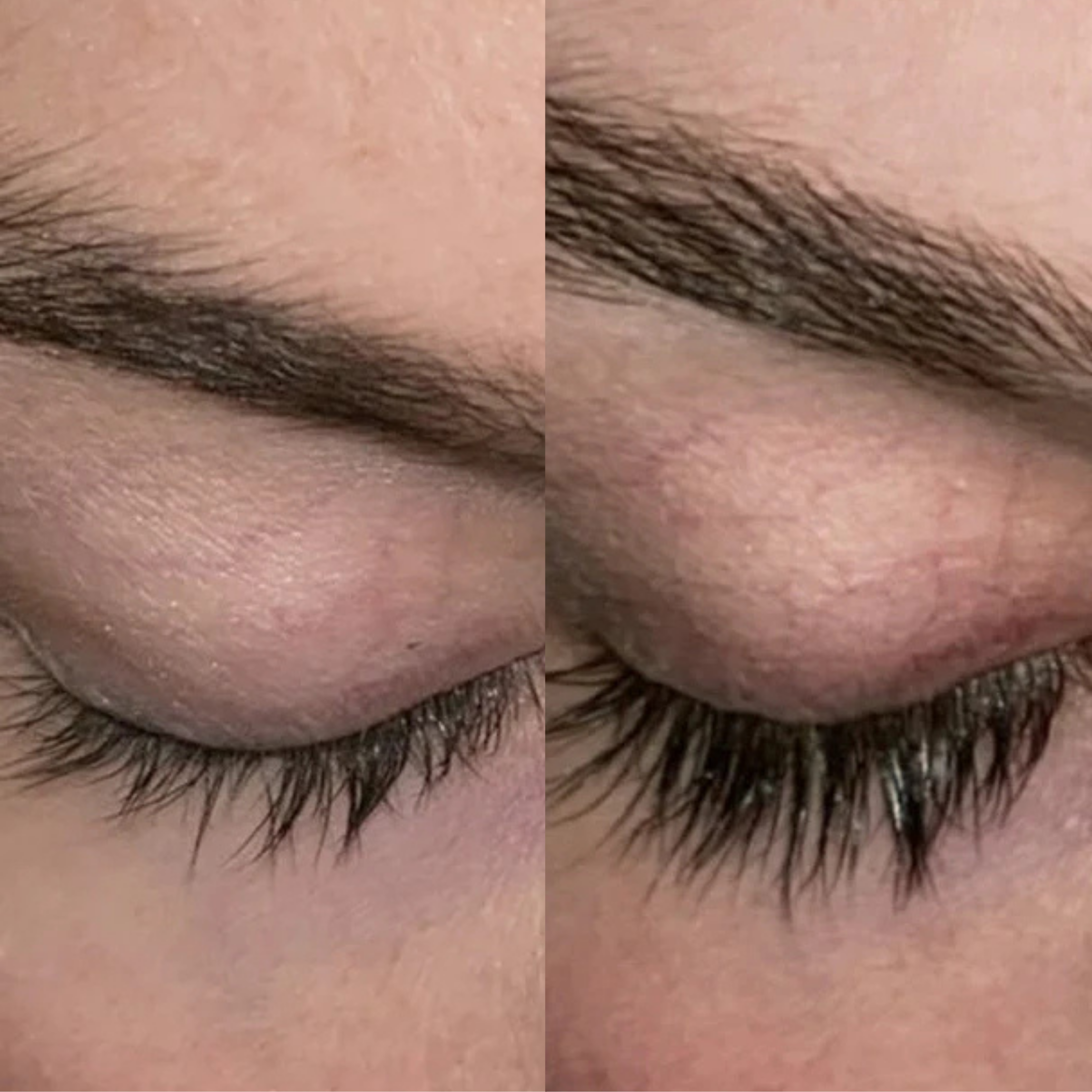 Xlash Eyelash Serum, 5ml