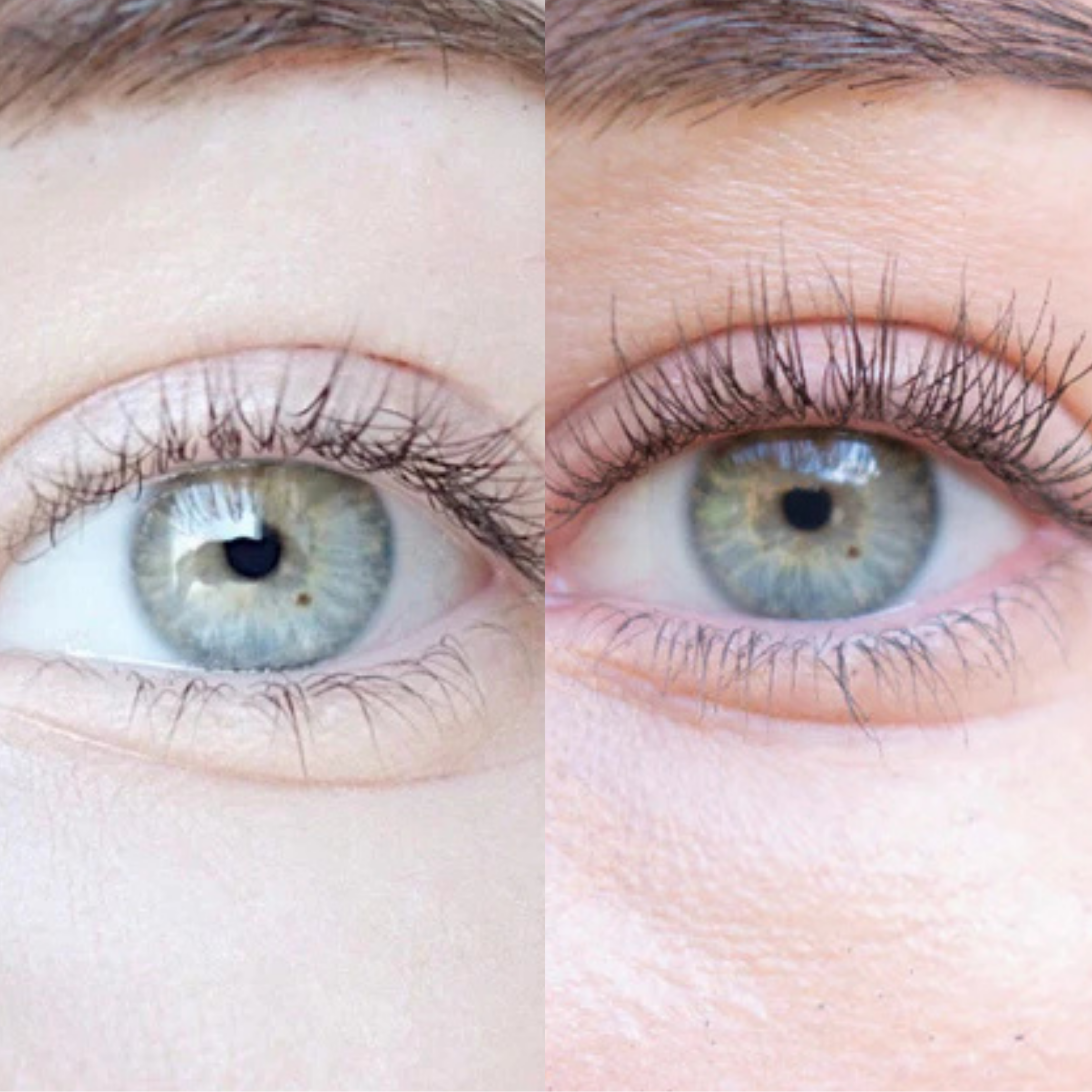 Xlash Eyelash Serum, 5ml
